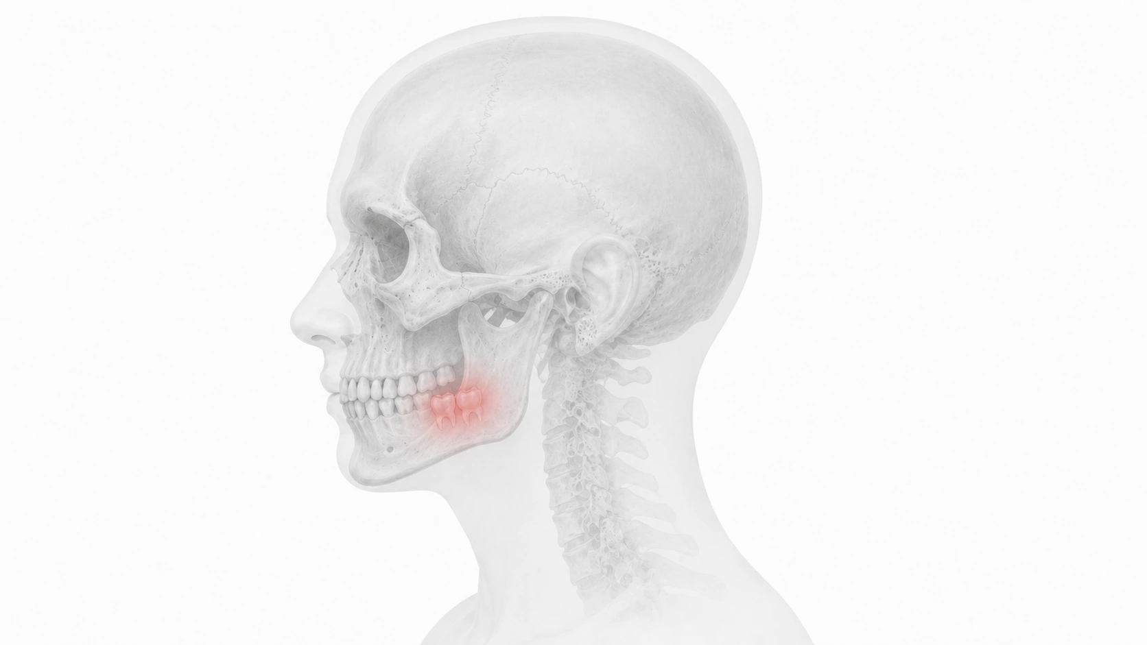 An X-ray of a head, the lower back molars flagged in red.